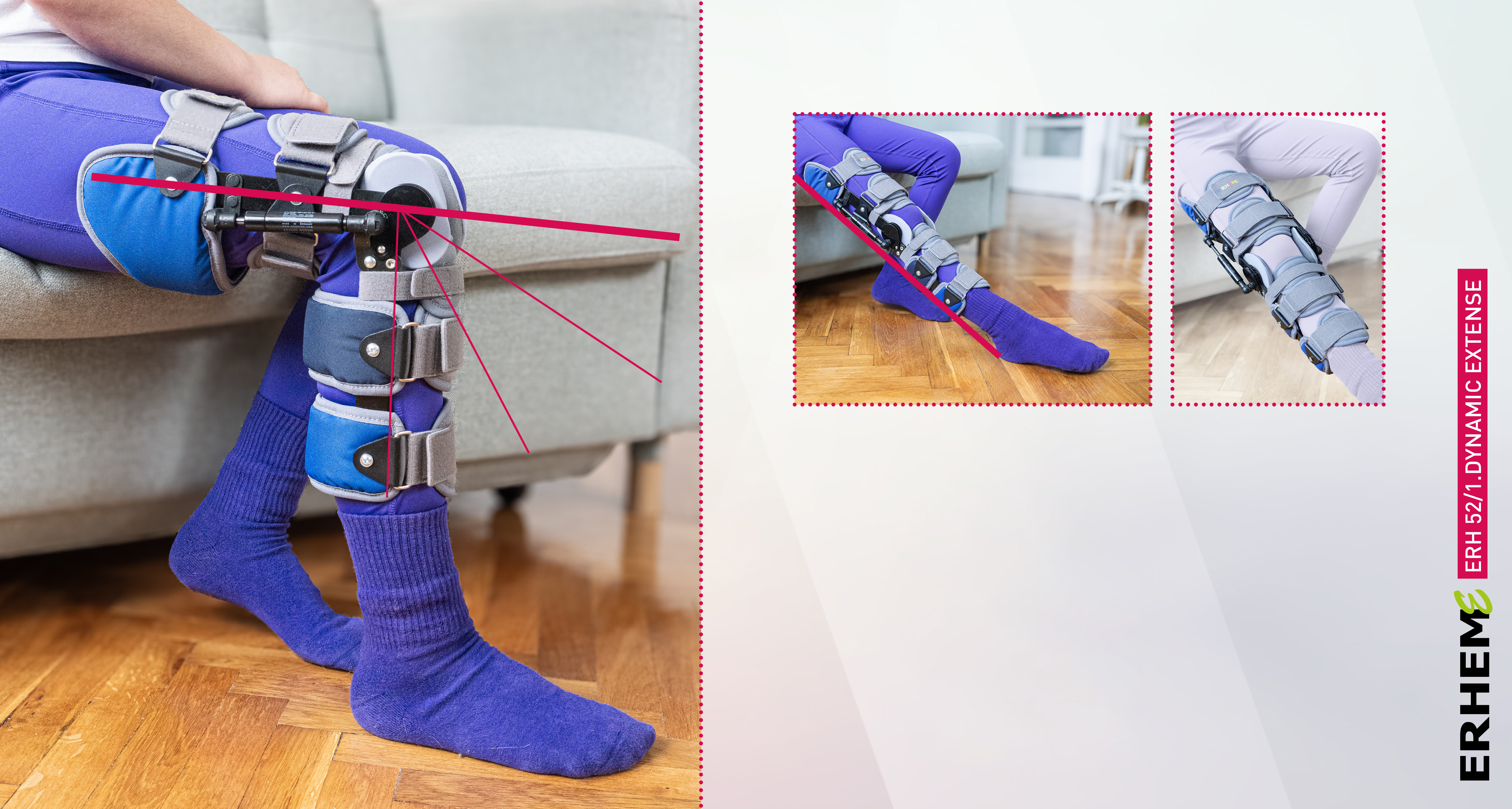 ERH 52/1 Tibia and thigh apparatus redressing the knee joint, Neuroextense series